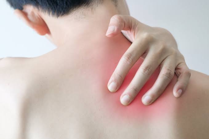Dorsal scapular nerve entrapment