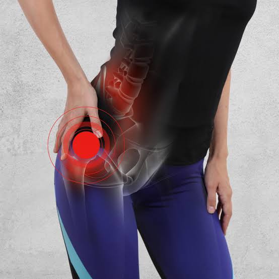 Snapping Hip Syndrome